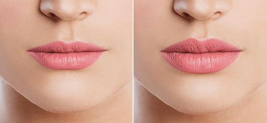 Come ottenere labbra morbide con un bel colore naturale - InfinityMarket