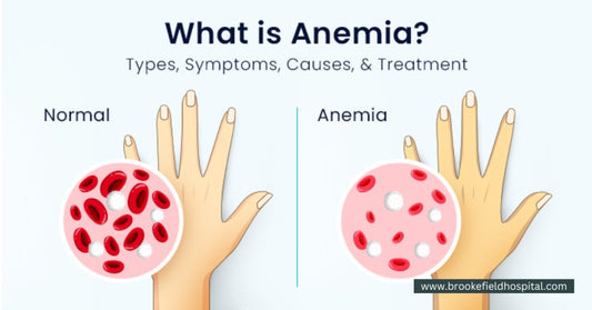 Quali sono i sintomi dell'anemia? - InfinityMarket